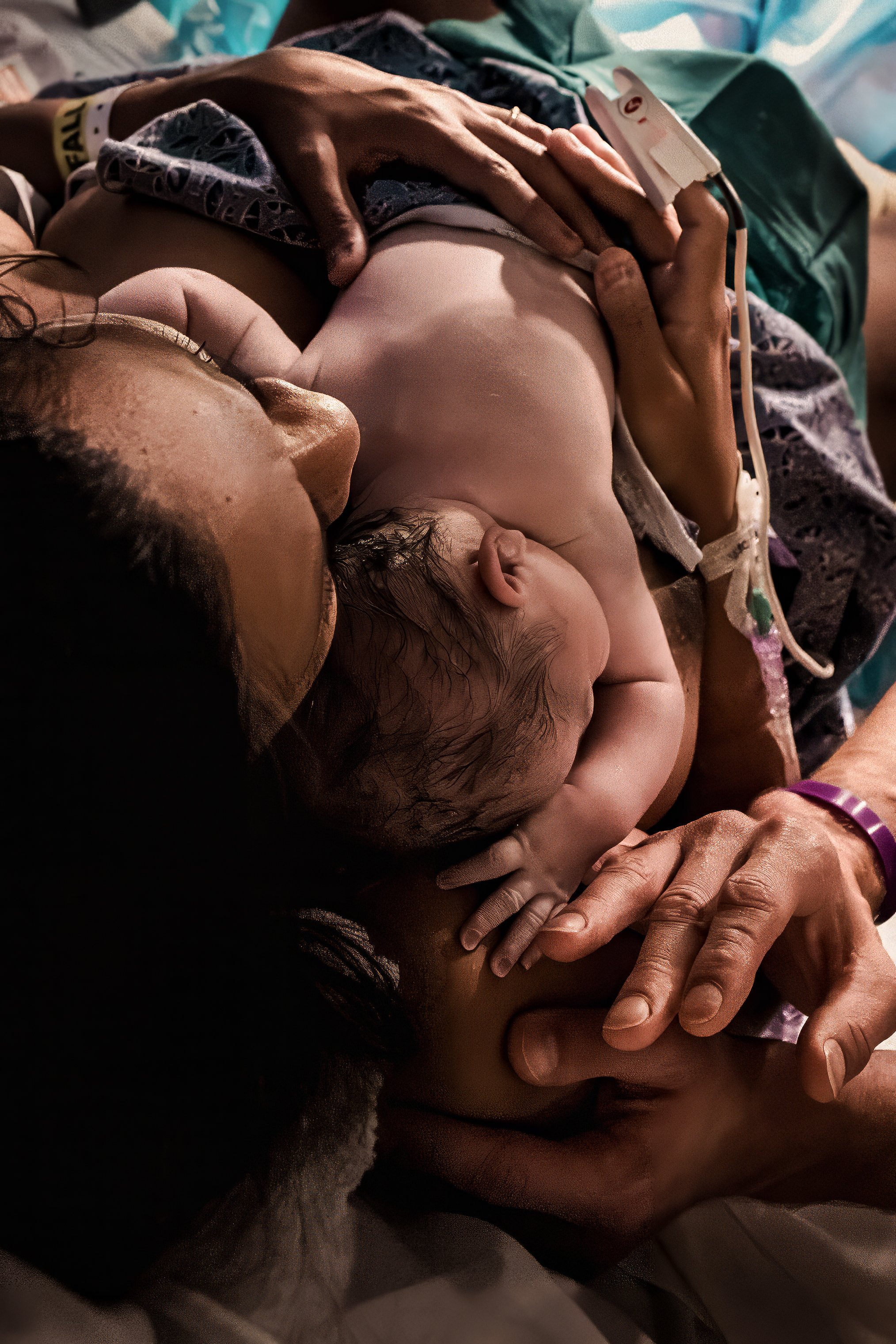 A fresh newborn resting on their mother's chest right after birth